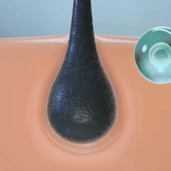 Feature product image